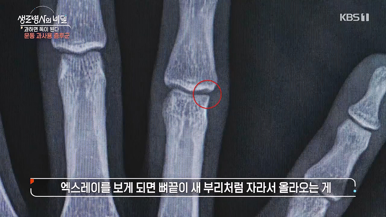 생로병사의 비밀.E918.240704p-NEXT.mp4_20240704_201609.683.jpg