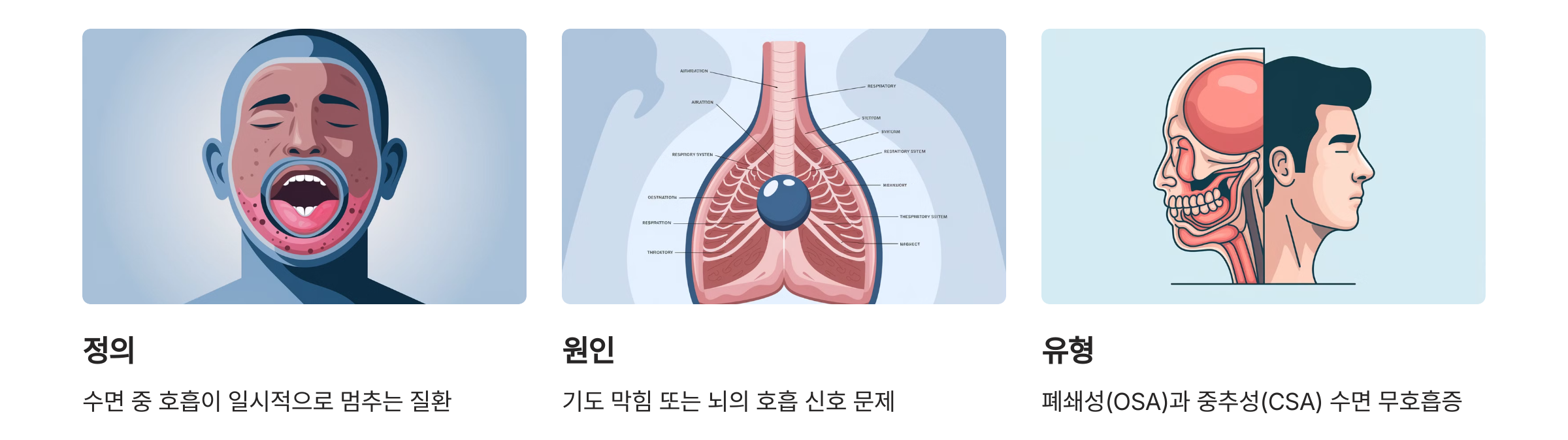 수면 무호흡증이란?