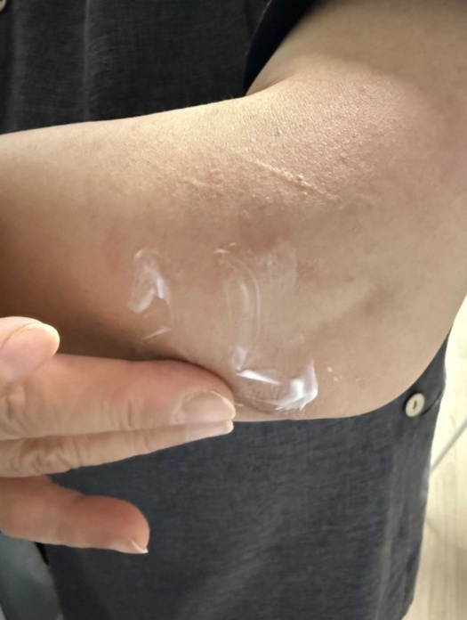옵티서머린 후기