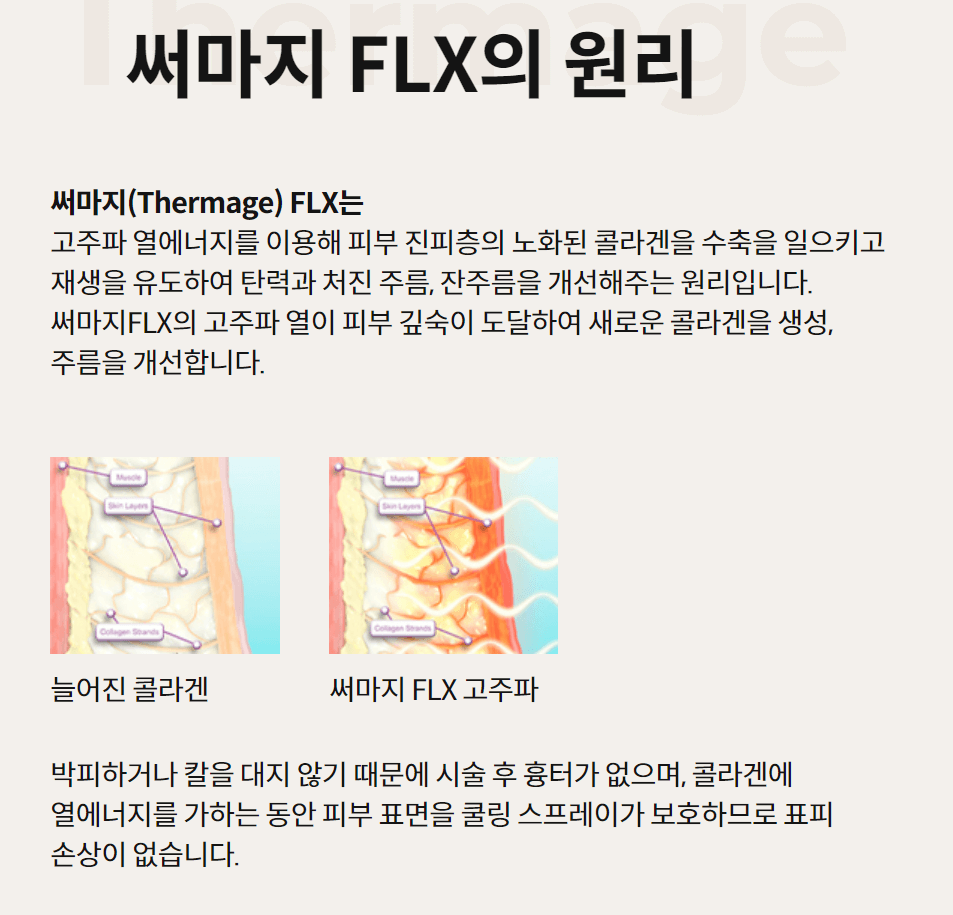 써마지 flx 효과 가격 써마지 후기