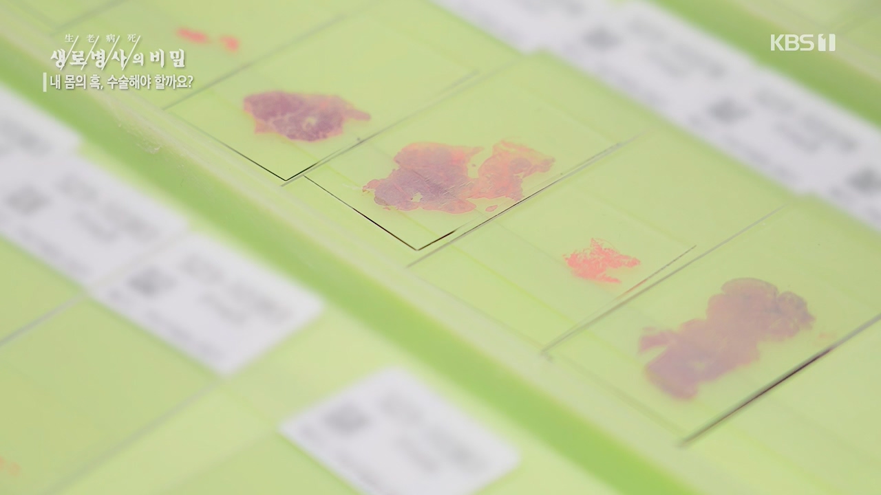 생로병사의 비밀.E870.230532p.H264-F1RST.mp4_20230605_201518.735.jpg