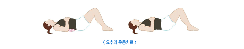 허리디스크 증세