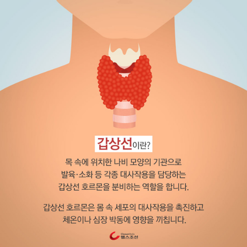  갑상선 종류와 원인 예방법과 치료방법 알아보자