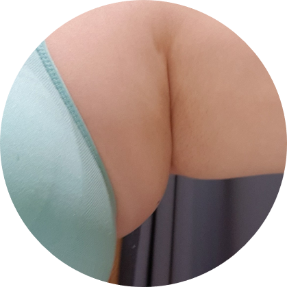 좋네요. 2회차 후기 지방분해주사 팔뚝살빼기 딱 5