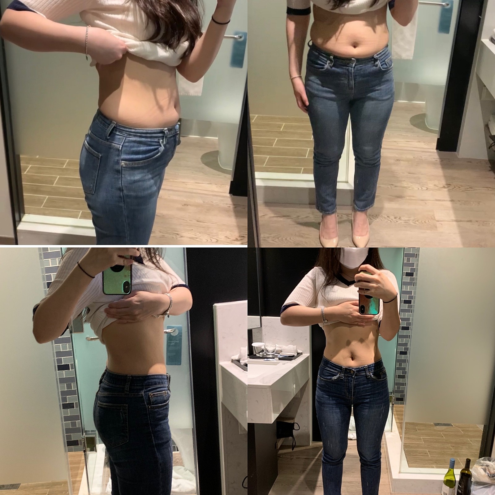 [D4] 대전램스지방추출주사 :: 전복부+러브핸들램스 4주차 리얼리뷰