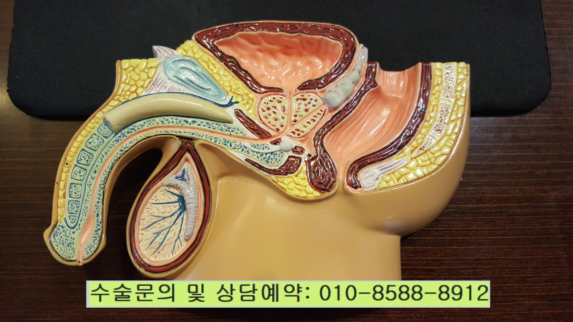  토평동정관수술 아내를 사랑한다면...^^