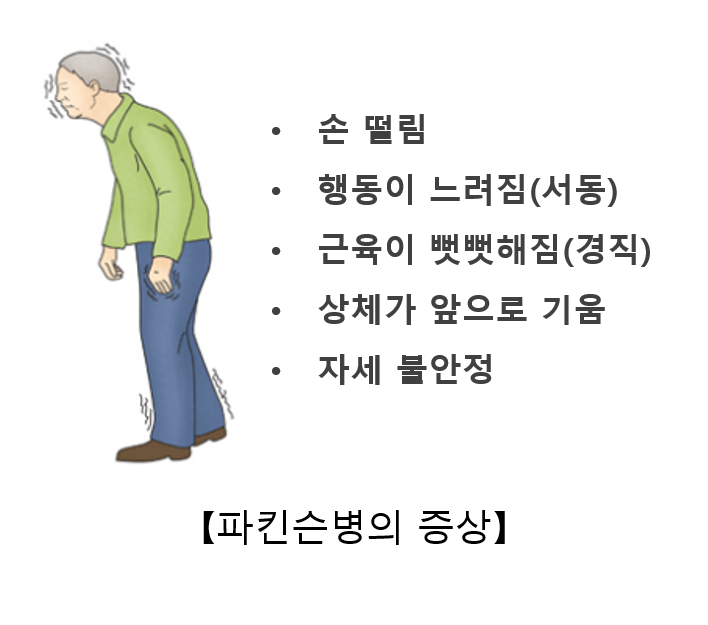 파킨슨병 초기증상과 장애등급