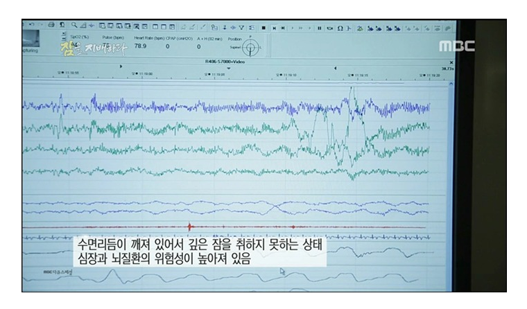  수면이 우리 몸에 미치는 영향