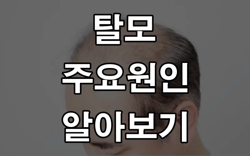 탈모 원인