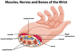 손목터널증후군(5)