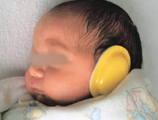 신생아 청력검사의 시기