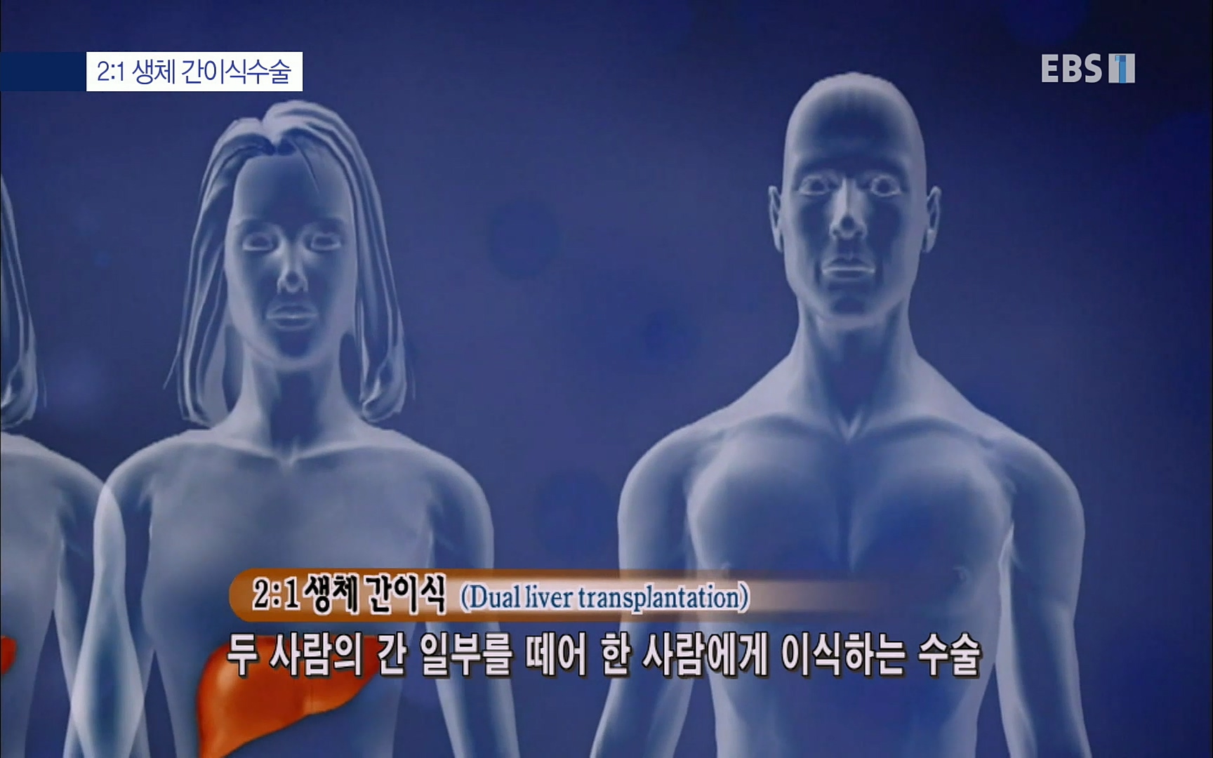 EBS 명의 헬스케어 - TV - 교육의 중심 EBS명의 15년 - 간, 완치에 도전하다.mp4_20220802_200800.923.jpg