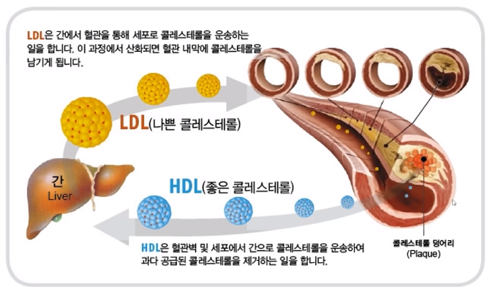 콜레스테롤