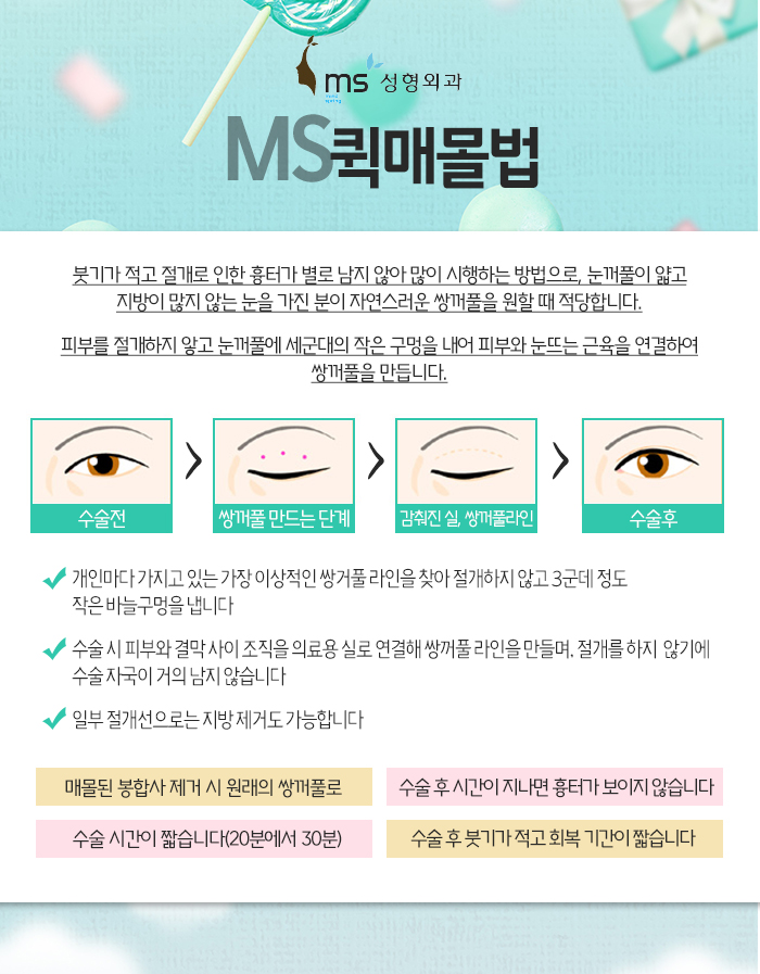 풀림 이미지