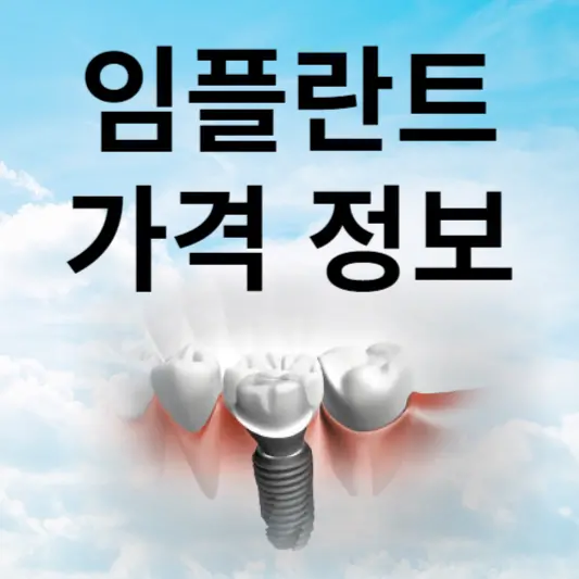 임플란트 가격 정보