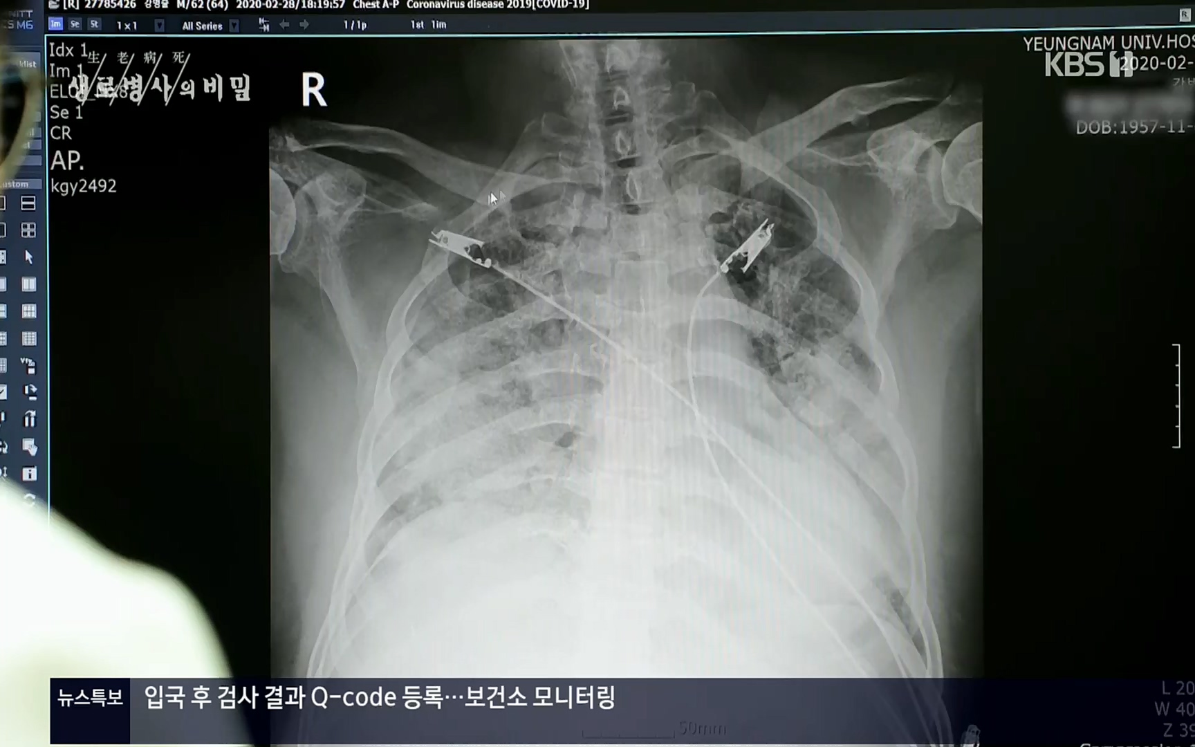 생로병사의 비밀.E827.220720p.H264-F1RST.mp4_20220721_203841.555.jpg