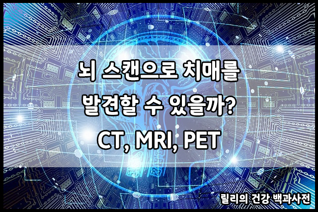  치매 : 뇌 스캔으로 치매나 알츠하이머를 찾아낼 수 있을까?
