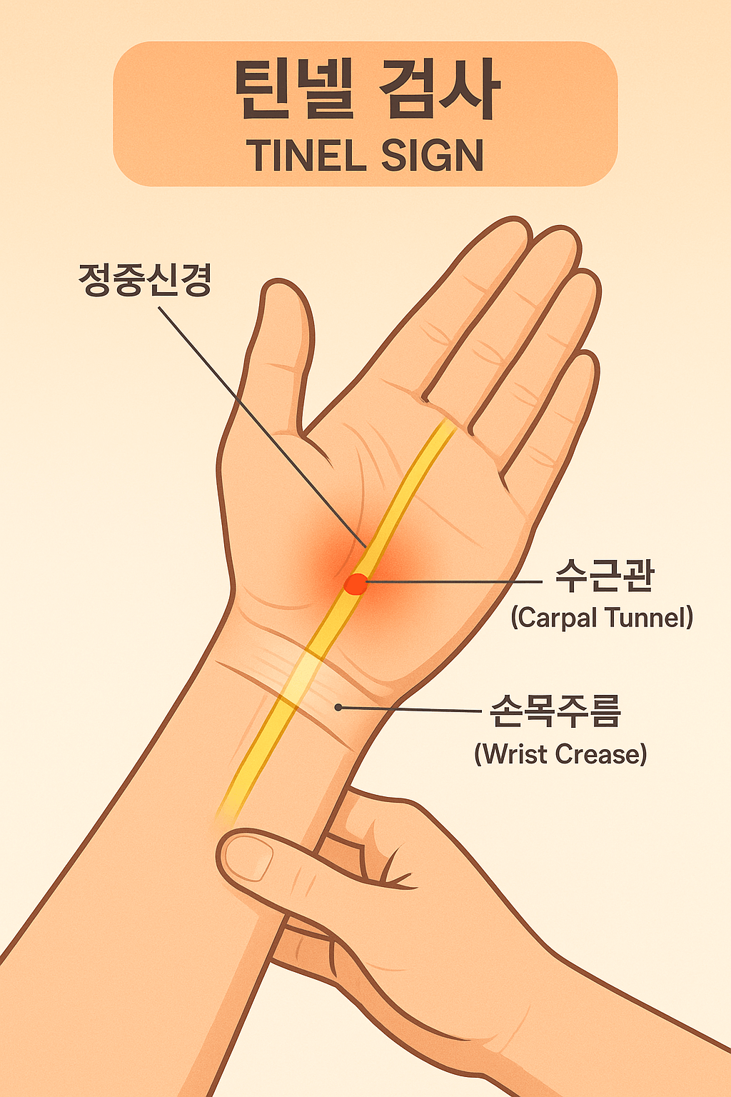 틴넬 검사 위치 안내도