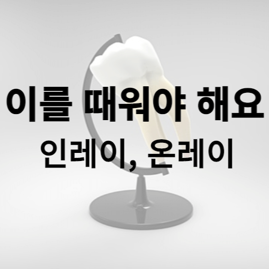 인레이&#44; 온레이 썸네일