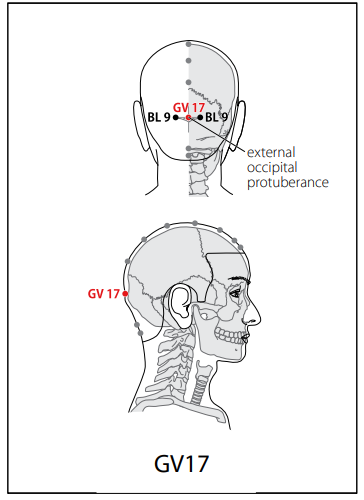 독맥 (GV) > GV17 뇌호 (腦戶) 1
