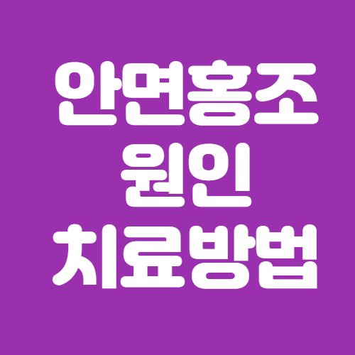  안면홍조증 원인 및 치료방법