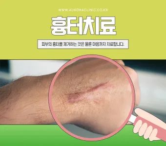 흉터전용 치료 추천 스카덤 겔 효능효과_10