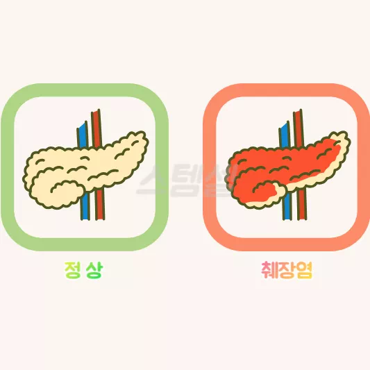 정상-췌장
췌장-비교
췌장염