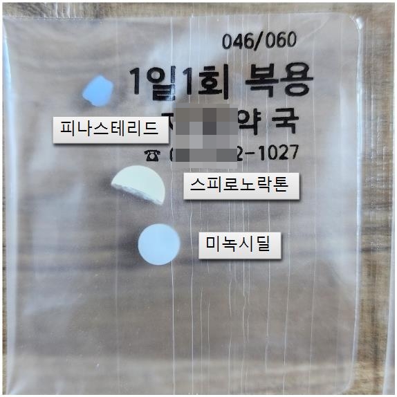 부산 자혜내과 탈모약