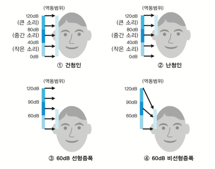  [청각장애의 특성] - 어음청취능력, 역동범위, 주파수해상도, 시간분별력, 신호대잡음비