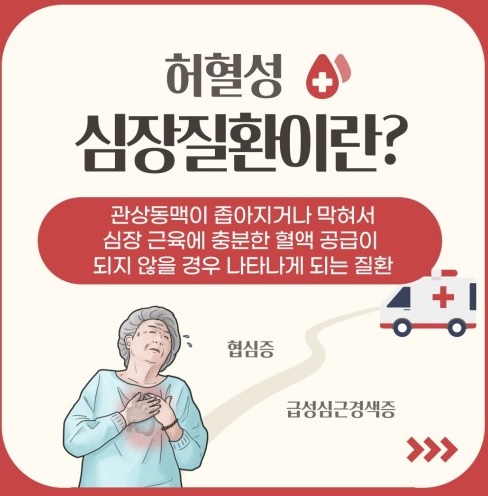 허혈성 심장질환