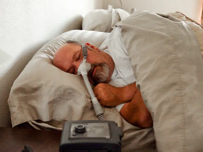 기도의 부분 또는 완전 폐쇄가 발생하는 폐쇄성 수면 무호흡증을 가진 성인은 그렇지 않은 성인보다 롱 코비드를 겪을 위험이 75% 더 높았다.