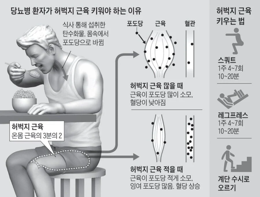 당뇨병 환자가 허벅지 근육 키워야 하는 이유
식사 통해 섭취한 탄수화물, 몸속에서 포도당으로 바뀜
포도당
근육
혈관
허벅지 근육
키우는 법
허벅지 근육
온몸 근육의 3분의 2
허벅지 근육 많을 때
근육이 포도당 많이 소모, 혈당이 낮아짐
스쿼트 1주 4~7회 10~20분
레그프레스 1주 4~7회 10~20분
허벅지 근육 적을 때
근육이 포도당 적게 소모, 잉여 포도당 많음. 혈당 상승
계단 수시로
오르기