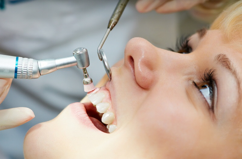 치아 스케일링 의료보험 및 비용