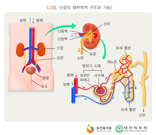 만성신부전증