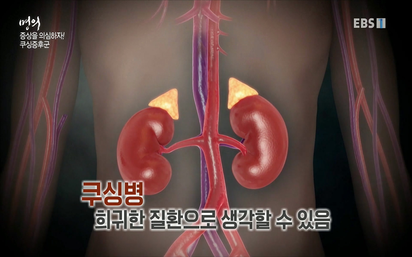 EBS 명의 헬스케어 - TV - 교육의 중심 EBS내 몸을 지배하는 7가지 호르몬 2부, 증상을 의심하자!.mp4_20220711_200210.604.jpg