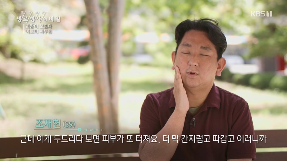 생로병사의 비밀.E872.230628p.H264-F1RST.mp4_20230707_214223.077.jpg
