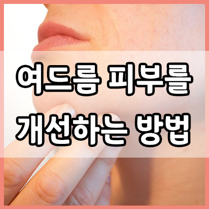  여드름 피부를 개선하는 열 네가지 방법
