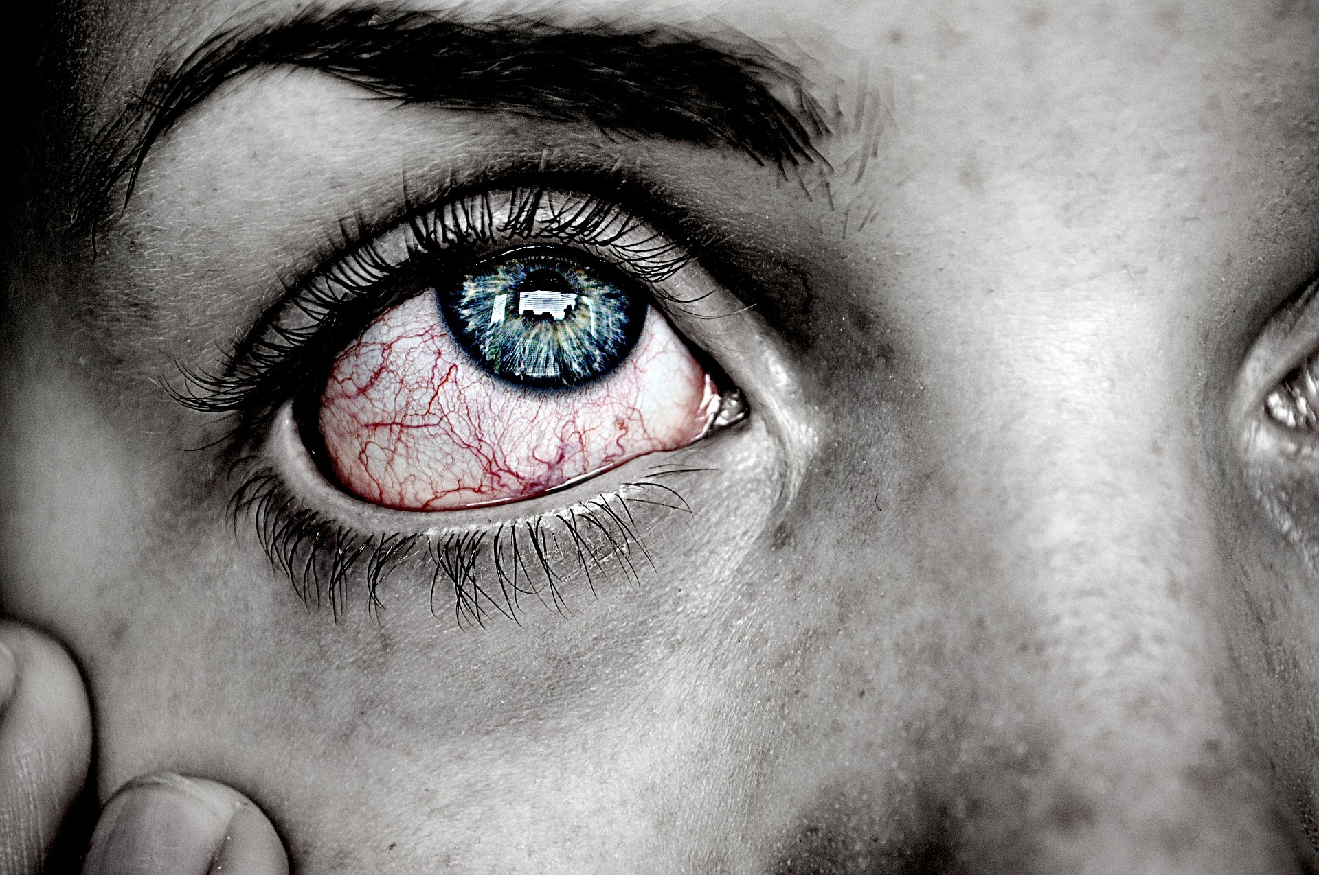 안피로증후군으로 인해 눈이 많이 충혈되고 아프고&#44; 피곤함 때문에 눈을 만지고 있는 사진