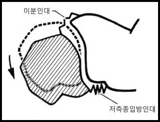 종골과 입방골의 움직임 제한을 만드는 이분인대를 나타낸 그림