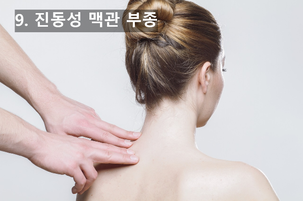 진동성 이미지
