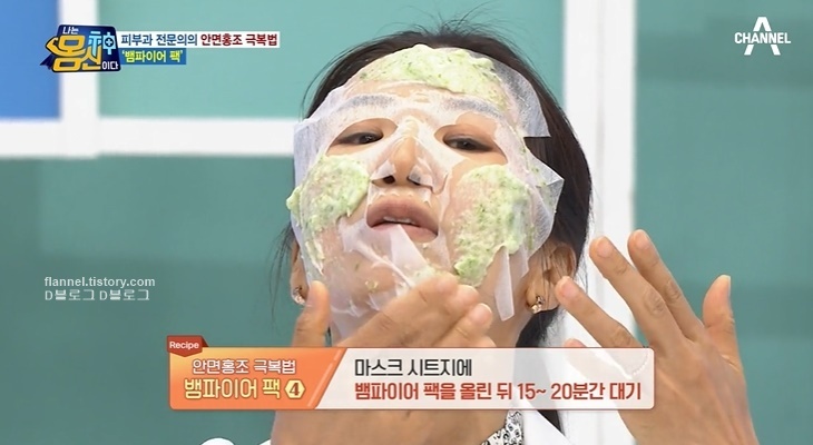  몸신 뱀파이어팩 만들기 안면홍조 치료방법