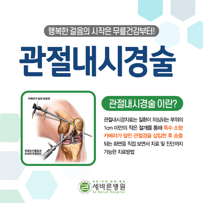  무릎연골연화증 방치하면 퇴행성무릎관절염으로 진행