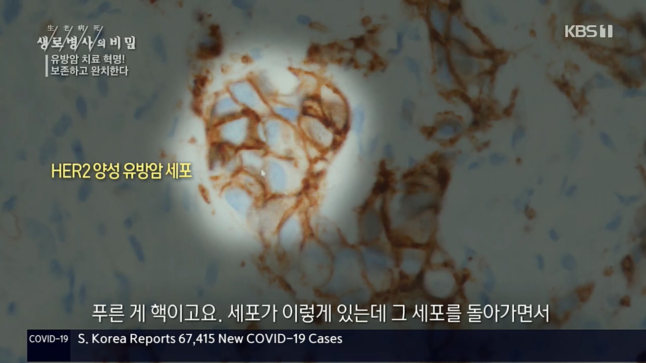 생로병사의 비밀.E845.221131p.H264-F1RST.mp4_20221201_215318.166.jpg