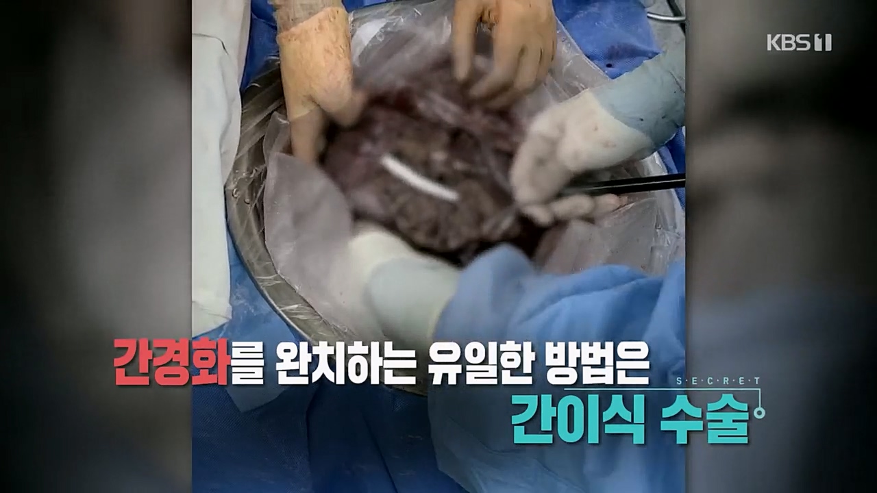 생로병사의 비밀.E863.230406p.H264-F1RST.mp4_20230406_200013.523.jpg