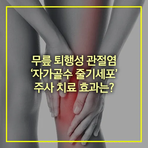 무릎 퇴행성 관절염 줄기세포 주사 치료 효과