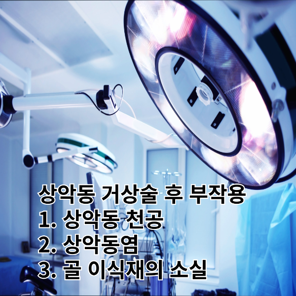 상악동거상술-부작용-썸네일