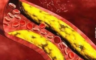 쌍화탕 효능 13