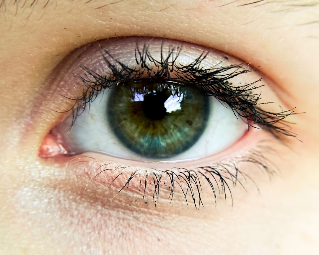Cataract