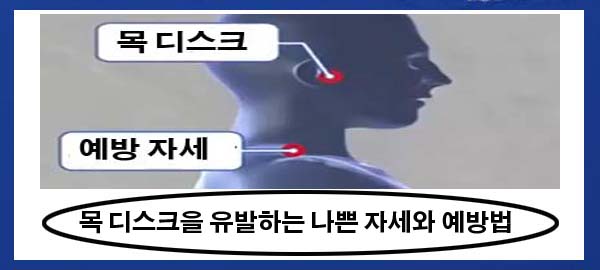  관절과 척추 건강에 나쁜 자세와 예방법