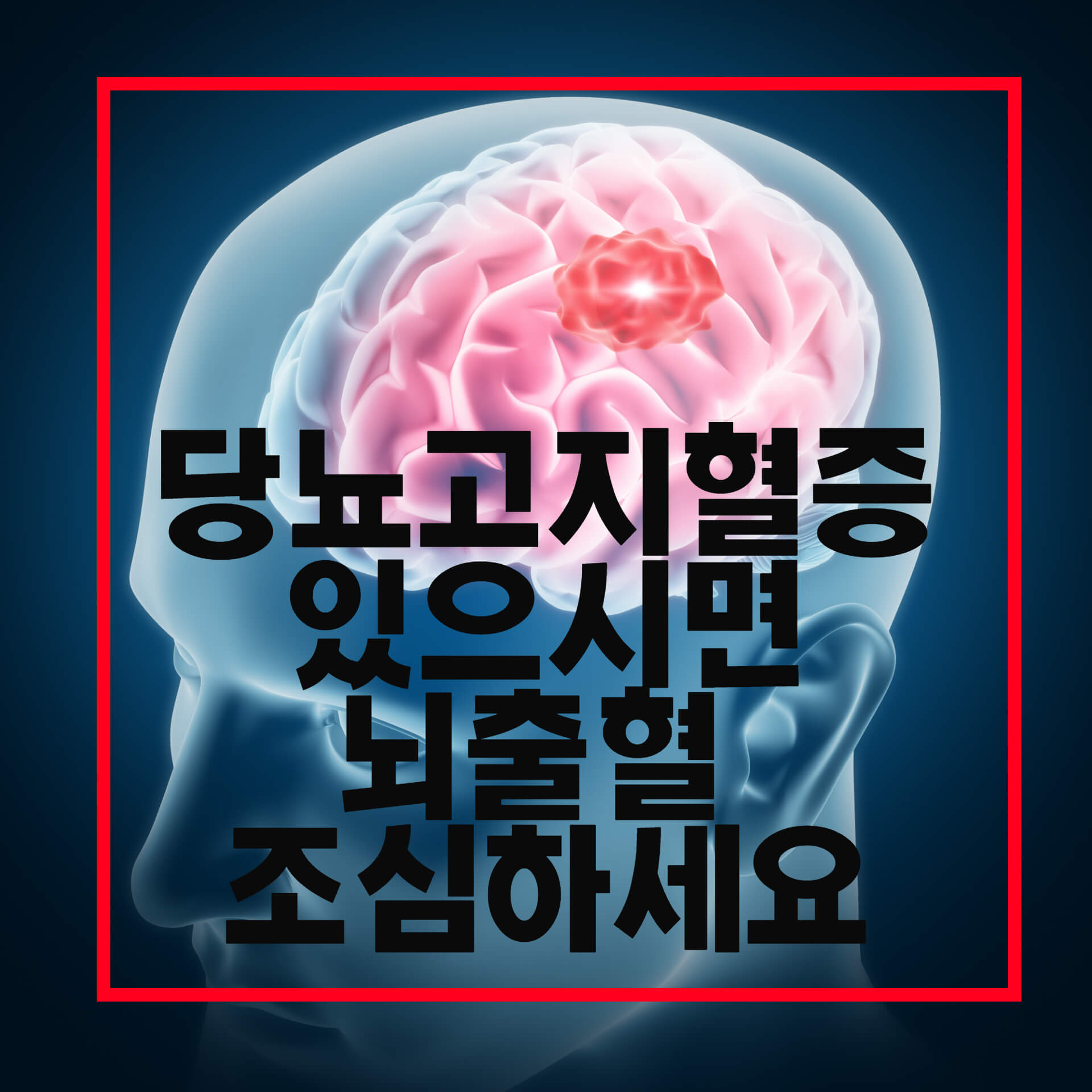  뇌출혈초기증상 응급처치 예방방법